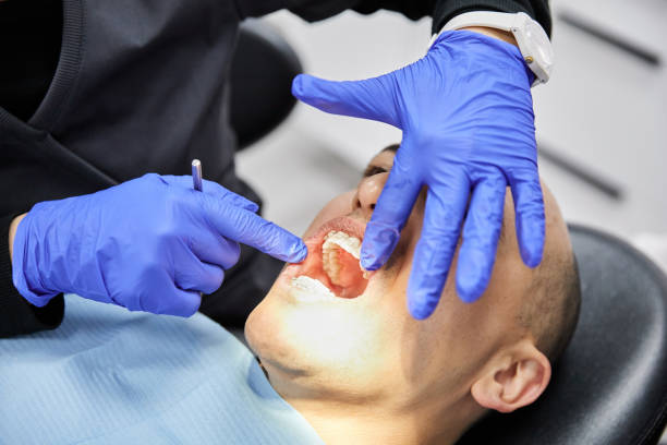 Best Emergency Root Canal Treatment in Experiment, GA